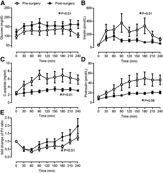 Figure 2. Glucose (A), insulin (B), C-peptide (C), and proinsulin (D) levels before (white circles) and after (dark squares) partial pancreatectomy. E: Fold change in proinsulin-to-insulin (P/I) ratio during MMT before (white circles) and after (dark squares) partial pancreatectomy. *P < 0.01 for pancreatectomy (A–C); *P = 0.08 for pancreatectomy (D); #P value for interaction = 0.01 (E).