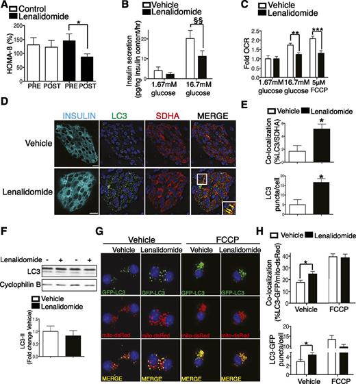 Figure 1. The selective ubiquitin ligase inhibitor lenalidomide impairs β-cell function, Nrdp1 ubiquitination, and mitophagy. A: Calculated HOMA-β measured in multiple myeloma patients preinitiation (pre) and 12 weeks postinitiation (post) of chemotherapy (n = 11 control and 14 lenalidomide). B: GSIS after static incubations in 1.67 mmol/L and 16.7 mmol/L glucose performed in isolated CD1 islets pretreated with vehicle (DMSO) or 10 μmol/L lenalidomide for 24 h (hr) (n = 4/group). C: Fold oxygen consumption rates (OCR) in isolated islets pretreated with vehicle or 10 μmol/L lenalidomide for 24 h prior to dispersion to single cells for analysis as adherent monolayers on Seahorse flux analyzer (n = 10/group). D: Representative images of pancreas sections from C57BL/6 mice treated for 3 weeks in vivo with 50 mg/kg lenalidomide or vehicle alone, stained for insulin (cyan), LC3 (green), and SHDA (red). Nuclei are demarcated with DAPI (blue). Inset (lower right): Focused area of LC3/SDHA colocalized structures demarcated by yellow arrows. Scale bars = 10 µm. n = 4/group. E: Quantification of LC3/SDHA colocalization and total LC3+ puncta in islets from C57BL/6 mice treated in vivo with or without 50 mg/kg lenalidomide (n = 4/group and ∼900 β-cells and ∼25,000 total LC3/SDHA structures quantified/group). F: Representative Western blot of LC3 levels in isolated islets treated with vehicle or 10 μmol/L lenalidomide for 24 h with quantification (by densitometry) of LC3-II levels normalized to cyclophilin B. n = 4/group. G: Representative deconvolution images of Min6 β-cells (transfected with LC3-GFP and mito-DsRed plasmids) then treated with vehicle or 10 μmol/L lenalidomide for 24 h with addition of 5 µmol/L FCCP for the final 4 h. n = 4/group. H: Quantification of LC3-GFP/mito-DsRed and mito-DsRed colocalization and total LC3-GFP puncta in Min6 β-cells treated with vehicle or 10 μmol/L lenalidomide for 24 h with addition of 5 µmol/L FCCP for the final 4 h. (n = 4/group and ∼1,500 total GFP and DsRed puncta quantified per experiment.) *P < 0.05, **P < 0.01, ***P < 0.001 by nonpaired Student t test; $$P < 0.01 by paired Student t test.