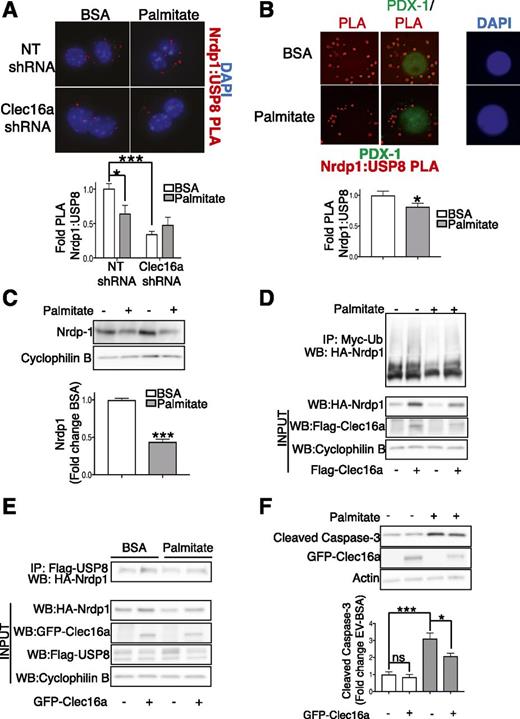 Figure 6. The Clec16a-Nrdp1-USP8 complex is perturbed by glucolipotoxicity. A: Top, representative deconvolution image of Nrdp1:USP8 Proximity Ligation Assay (PLA, red; DAPI, blue) in Min6 β-cells 72 h after transfection with nontargeting (NT) or Clec16a-specific shRNA plasmids after treatment with BSA control or 0.4 mmol/L palmitate for 48 h; bottom, quantification of relative Nrdp1:USP8 PLA events in Min6 β-cells (fold change vs. NT shRNA BSA controls). (n = 4/group and ∼1,200 PLA events quantified/group per experiment.) B: Top, representative deconvolution image of Nrdp1:USP8 PLA (PLA, red; PDX1, green; and DAPI, blue) in β-cells of dissociated human islets after 48 h treatment with BSA control (BSA) or 0.4 mmol/L palmitate and 0.92% BSA + 20 mmol/L glucose (palmitate); bottom, quantification of relative Nrdp1:USP8 PLA events in β-cells of dissociated human islets after control BSA (white bar) or 0.4 mmol/L palmitate and 0.92% BSA + 20 mmol/L glucose (gray bar) treatment for 48 h (n = 3 donors and ∼900 β-cell PLA events quantified/group per donor). C: Top, representative Western blot (WB) of Nrdp1 levels in isolated mouse islets treated for 48 h with or without 0.4 mmol/L palmitate + 20 mmol/L glucose; bottom, relative quantification (by densitometry) of Nrdp1 levels by Western blot in isolated islets from mice treated for 48 h with (gray bars) or without (white bars) 0.4 mmol/L palmitate and 0.92% BSA + 20 mmol/L glucose. n = 3/group. D: Representative Western blot of in vivo ubiquitination assay of HA-Nrdp1 in Min6 cells transfected with HA-Nrdp1, Myc-tagged ubiquitin (Myc-Ub), and Flag–empty vector or Flag-Clec16a plasmids and treated for 48 h with or without 0.4 mmol/L palmitate/BSA coupling. n = 3/group. E: Representative Western blot after Flag-immunoprecipitation (IP) in Min6 cells transfected with HA-Nrdp1, Flag-USP8, and either GFP–empty vector or GFP-Clec16a plasmids and treated for 48 h with or without 0.4 mmol/L palmitate. n = 4/group. F: Top, representative WB of cleaved caspase-3 levels in Min6 cells transfected with or without GFP-Clec16a and treated for 48 h with BSA or palmitate; bottom, relative quantification (by densitometry) of cleaved caspase-3 levels (normalized to actin loading control) by Western blot in Min6 cells transfected with or without GFP-Clec16a and treated for 48 h with BSA (white bars) or palmitate (gray bars) couplings. n = 5/group. *P < 0.05, ***P < 0.001, nonpaired Student t test. ns, not significant.