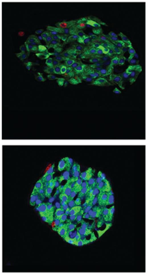 Immunohistochemical staining of pancreata from sham-operated (top) and sleeve gastrectomy-operated (bottom) mice. Sleeve gastrectomy reduces β-cell proliferation back to levels seen in lean mice. Nuclear Ki67 staining marking proliferating cells shown with arrows.