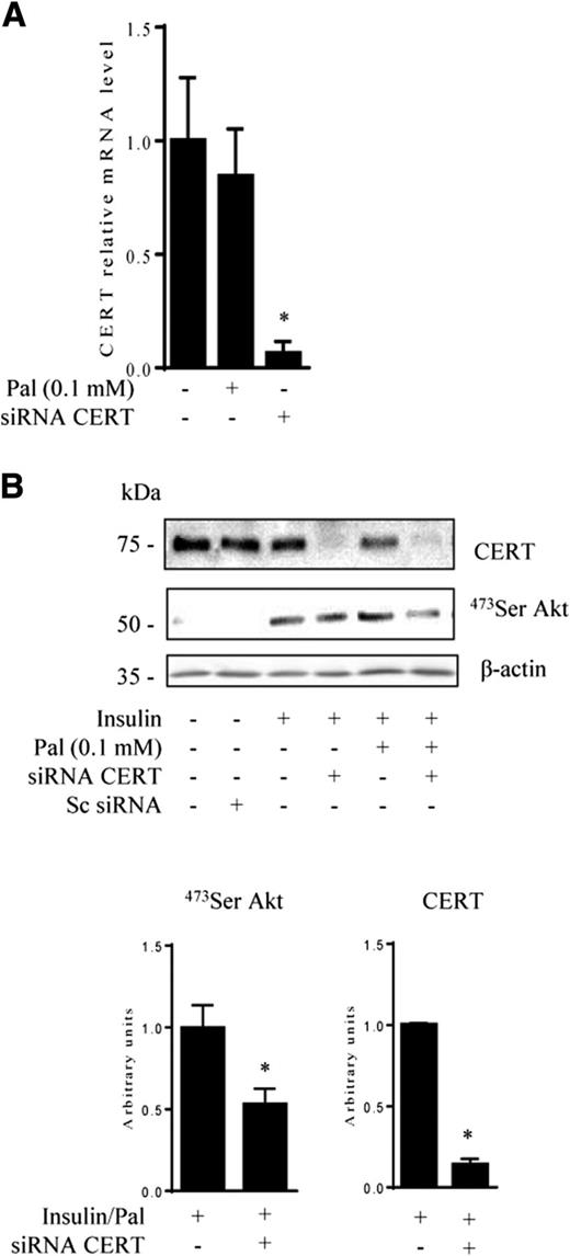 Figure 3. Effect of CERT siRNA on palmitate (Pal)-induced IR in C2C12 myotubes. A: C2C12 myotubes were transfected with a CERT siRNA (25 nmol/L for 72 h) or a scrambled (Sc) siRNA (25 nmol/L for 72 h) and then treated with 0.1 mmol/L Pal for 16 h before RNA extraction. CERT mRNA was quantified by real-time quantitative RT-PCR. Data are mean ± SEM (n = 3). *P < 0.05, relative to control. B: C2C12 myotubes were transfected with a CERT siRNA (25 nmol/L for 72 h) or an Sc siRNA (25 nmol/L for 72 h) and then treated with 0.5 mmol/L Pal for 16 h and 100 nmol/L insulin during the last 10 min of culture before being lysed. Cell lysates were immunoblotted with the indicated antibodies. Histograms show densitometric quantification of both CERT and Ser-473 Akt. Data are mean ± SEM (n = 3). *P < 0.05, relative to insulin/Pal-treated cells.