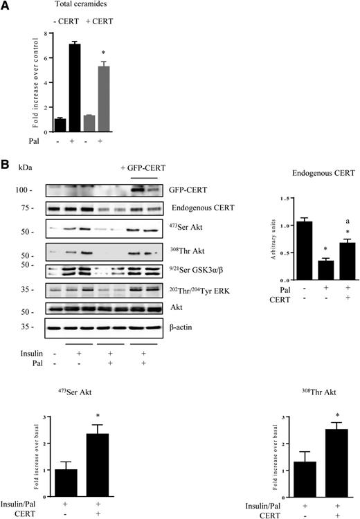 Figure 4. Effect of CERT overexpression on palmitate (Pal)-induced IR in C2C12 myoblasts. C2C12 myoblasts were transfected with a CERT-GFP plasmid and then incubated with 0.75 mmol/L Pal for 16 h and 100 nmol/L insulin for the last 10 min. A: Total ceramide concentration was assessed. Data are mean ± SEM (n = 3). *P < 0.05, relative to Pal-treated cells. B: Cell lysates were immunoblotted with the indicated antibodies. Histograms show densitometric quantification of endogenous CERT, Ser-473 Akt, and Thr-308 Akt. Data are mean ± SEM (n = 3). Upper panel, *P < 0.05, relative to control cells; aP < 0.05, relative to Pal-treated cells. Lower panel, *P < 0.05, relative to insulin/Pal-treated cells.
