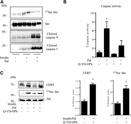 Figure 5. Involvement of caspases in the regulation of CERT expression and insulin sensitivity in lipotoxic conditions. A: C2C12 myotubes were incubated with 0.75 mmol/L palmitate (Pal) for 16 h before being lysed. Cell lysates were immunoblotted with the indicated antibodies. B: C2C12 myotubes were incubated with 0.75 mmol/L Pal with or without 20 μmol/L caspase inhibitor (Q-VD-OPh) for 16 h and then caspase activity was assessed. Data are mean ± SEM (n = 3). *P < 0.05, relative to control. C: C2C12 myotubes were treated with 0.75 mmol/L Pal with or without 20 μmol/L Q-VD-OPH for 16 h and then with insulin in the last 10 min before being lysed. Cell lysates were immunoblotted with the indicated antibodies. Histograms show densitometric quantification of both CERT and Ser-473 Akt. Data are mean ± SEM (n = 4). *P < 0.05, relative to insulin/Pal-treated cells.