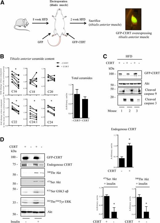 Figure 7. Consequences of CERT overexpression on insulin signaling and ceramide content in mouse muscle in vivo. A: The left-side tibialis anterior muscle from 8-week HFD-fed mice was transfected with GFP-CERT cDNA, and the right-side with a GFP cDNA. Fourteen days later, mice were injected with insulin for 30 min and sacrificed. Tibialis anterior muscles were collected under fluorescence microscope and lysed. B: Both ceramide species and total ceramides from mouse tibialis anterior muscles were analyzed. Data are expressed as muscle ceramide fold change compared with the mean of the control group set as 1.0. Data are mean ± SEM (n = 7). *P < 0.05, relative to control tibialis anterior muscle. C: Cell lysates were immunoblotted with the indicated antibodies. Representative blots from three different animals are shown. D: Cell lysates were immunoblotted with the indicated antibodies. Representative blots and quantifications of Thr-308 and Ser-473 Akt signals from five animals are shown. Data are mean ± SEM (n = 5). *P < 0.05, relative to tibialis anterior muscle overexpressing CERT.