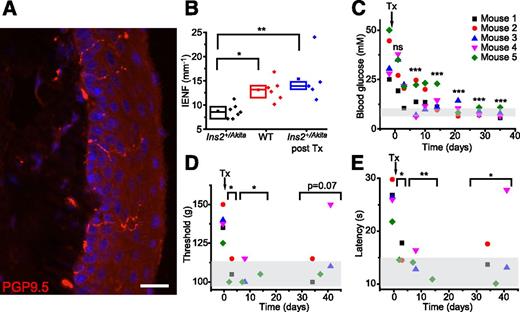 Figure 7. Recovery from sensory neuropathy after islet transplantation. A: IENFs were visualized by immunostaining for PGP9.5. Scale bar, 20 μm. B: The IENF density was significantly reduced in skin sections from male 20-week-old Ins2+/Akita mice compared with age-matched WT littermates. Male diabetic Ins2+/Akita mice were transplanted at an age of 14–20 weeks. After islet transplantation (5–6 weeks), the IENF density recovered to the level seen in healthy WT mice. C: Blood glucose concentration was progressively restored after islet transplantation, reaching normoglycemic levels after 2–3 weeks. The sensitivity to noxious mechanical (paw-pressure test, D) and cold (cold-plate assay, E) stimulation rapidly increased to WT level after islet transplantation (compare with WT in Fig. 1C and E). Individual data points from each of n = 5 transplanted mice are shown in C–E. The areas shaded in gray (C–E) indicate the level in male WT littermates (mean ± SD). Data in B are the individual raw values, and the box indicates the median with interquartile range of n = 5–7 mice. *P < 0.05, **P < 0.01, ***P < 0.001, ANOVA followed by Tukey (compared with Ins2+/Akita; B) or Dunnett (compared with pretransplantation; C–E) post hoc test.
