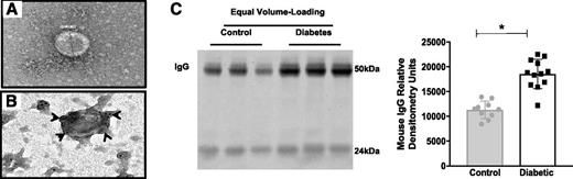 Figure 4. IgG bound to exosomes in plasma and an elevated number of exosomes in diabetes leads to a greater IgG level in mice with diabetes than in control mice. A and B: TEM images of rat plasma exosomes isolated by ultracentrifugation. A 138.89-nm-diameter exosome was visualized using TEM with uranyl-oxalate staining (A). Immunogold-labeled rat IgG colocalized with exosomes (arrowheads) (B). C: Western blot of mouse plasma exosomes isolated with ExoQuick (left). Under loading conditions of equal volume, more exosomes containing IgG were observed in diabetic mouse plasma (n = 12; white bar, black squares) than in control plasma (n = 10; gray bar, gray circles) (right). Exosomes were quantified on the basis of band intensity. All data points are shown as univariate scatter plots with mean and SD. *P < 0.05.