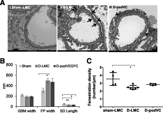 Figure 6. VEGFC intervention ameliorates early ultrastructural changes in DN. Mice given doxycycline at 4 weeks after STZ administration were cardiac perfusion fixed. Representative electron micrographs are shown at high power to show details of capillary loops in sham-LMC (Ai), D-LMC (Aii), and D-podVEGFC (D-podVC) (Aiii) mice. Arrows highlight reduced endothelial fenestration density, and arrowheads highlight flattened foot processes. Scale bars, 1 μm. B: Ultrastructural changes were quantified by measuring GBM width, podocyte foot process (FP) width (P < 0.05, one-way ANOVA), and slit diaphragm (SD) length (n = 4, 6, and 3, respectively; P < 0.001, one-way ANOVA). C: Endothelial fenestration density values per micrometer of GBM were also quantified (P < 0.05, one-way ANOVA). n = 4, 6, and 3. Bonferroni post hoc tests indicated: *P < 0.05, **P < 0.01.