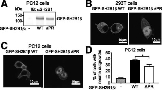Figure 3. Disruption of the PH domain changes the subcellular localization of SH2B1 and impairs the ability of SH2B1 to enhance NGF-induced neurite outgrowth. A: Proteins in whole-cell lysates from PC12 cells transiently expressing the indicated GFP-SH2B1β were immunoblotted with αSH2B1. Migration of molecular weight standards are on the left. IB, immunoblot. B and C: Live 293T cells and PC12 cells transiently expressing GFP-SH2B1β WT or GFP-SH2B1β ΔPR were imaged by confocal microscopy. D: PC12 cells transiently expressing GFP, GFP-SH2B1β WT, or GFP-SH2B1β ΔPR were treated with 25 ng/mL mouse NGF for 2 days, after which neurite outgrowth was assessed. GFP-positive cells were scored for the presence of neurites more than two times the length of the cell body (total of 300 cells/condition/experiment). The percentage of cells with neurites was determined by dividing the number of GFP-positive cells with neurites by the total number of GFP-positive cells counted. Data are mean ± SEM (n = 3). *P < 0.05.