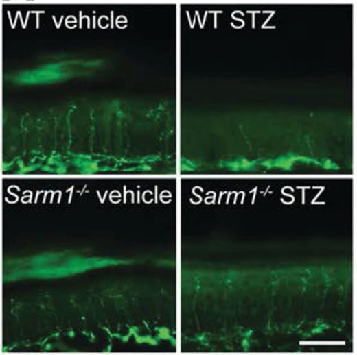 Representative images of intraepidermal nerve fiber profiles in wild-type (WT) and Sarm1–/– mice treated with vehicle or streptozotocin (STZ). Scale bar, 35 µm.