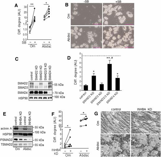Figure 3. Blockade of TGFβ signaling pathway markedly improved adipogenesis in Om ASCs. A: Paired Om and Abdsc ASCs were differentiated in the absence (−) or presence (+) of SB (5 μmol/L), and differentiation (Diff.) degree (ATGL protein) was measured on day 14. Each symbol represents ASCs derived from a different donor. Scale bars, 100 μm. B: Representative images of differentiated cells. Effects of depot and SB on adipogenesis were determined by two-way ANOVA followed by paired t tests (*P < 0.05, **P < 0.01; n = 5). C: Om ASCs were transfected with control, SMAD2, SMAD3, both SMAD2 and 3 (SMAD2/3), or SMAD4 siRNA, and KD levels were confirmed at confluence with immunoblotting. D: Cells were differentiated and PPARγ mRNA levels were measured as an adipocyte marker; dotted line represents the average value for paired Abdsc ASCs, differentiated in the control condition. Data were first analyzed by RM-ANOVA followed by Dunnett test to compare experimental values with the control (*P < 0.05 and **P < 0.01) and a paired t test to compare SMAD2/3 KD with SMAD2 KD alone (#P < 0.05); n = 6. E: Paired Om and Abdsc ASCs were transfected with control or activin A (INHBA) siRNA, and expression levels of activin A, phosphorylated SMAD2 (PSMAD) and total SMAD2 (TSMAD2), and HSP90 were measured at confluence. F: Differentiation degree was evaluated by measuring ATGL protein levels on day 14. Each symbol represents ASCs derived from a different subject. G: Representative images of differentiated cells are presented. Depot and siRNA effects on adipogenesis were determined by two-way ANOVA followed by paired t tests (*P < 0.05; n = 5).