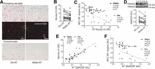 Figure 7. Higher pericellular fibrosis in Om was correlated positively with tissue TGFβ signaling activity and negatively with ASC differentiation (diff.). A: Adipose tissue (AT) samples were used for picrosirius red and trichrome staining of collagen, and representative images from a donor are presented. Scale bars, 100 µm. B: Levels of pericellular fibrosis were quantified in picrosirius red–stained slides and presented as percent of stained to total area (% SR). *P < 0.05 (paired t test), n = 20 (mean ± SEM BMI 42.7 ± 2.1 kg/m2 [range 23–63] and age 38.7 ± 2.6 years [20–56], with 14 females and 6 males). C: Inverse correlations between pericellular fibrosis and differentiation degree of ASCs derived from the same donors. D: SMAD2P in Om and Abdsc adipose tissues was measured with immunoblotting. *P < 0.05 (paired t test; n = 14). E: Positive associations between tissue SMAD2P and fibrosis (percent of stained to total area). F: Negative associations between tissue SMAD2P and differentiation degree of ASCs derived from the same donors. The numbers of subjects, Pearson correlation coefficients (r), P values, and number of samples are shown in each panel. AU, arbitrary units. O, Om; S, Abdsc.
