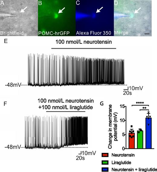 Figure 4. NT and liraglutide effects on Pomc neuron activity. Brightfield illumination of Pomc-hrGFP neuron (A), the neuron under FITC (hrGFP) illumination (B), and complete dialysis of Alexa Fluor 350 from the intracellular pipette (C). D: Merged image illustrates colocalization of brightfield, hrGFP, and Alexa Fluor 350 indicative of a Pomc neuron. Scale bar = 50 μm. E: Current-clamp recording demonstrates that NT (100 nmol/L) depolarized Pomc neurons. F: Current-clamp recording demonstrates a Pomc-hrGFP neuron is depolarized by NT (100 nmol/L) and liraglutide (100 nmol/L). G: NT, liraglutide, and combination treatment induced change in membrane potential. Data are mean ± SD. **P < 0.01; ****P < 0.0001. Data tested with one-way ANOVA with Tukey multiple comparison test (n = 3–7).