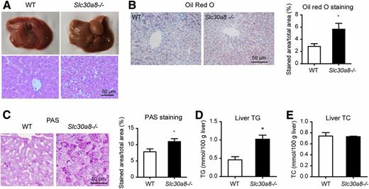 Figure 3. Slc30a8−/− mice have increased lipid and glycogen deposition in the liver. A: Gross morphology (top) and representative hematoxylin-eosin images (bottom) of liver from wild-type (WT) and Slc30a8−/− mice. B: Representative images and quantitative analysis of Oil red O staining. C: Representative images and quantitative analysis of PAS staining. D and E: Hepatic total triglycerides (TG) and total cholesterol (TC) levels in WT and Slc30a8−/− mice. Data are mean ± SEM. *P < 0.05 by unpaired Student t test.