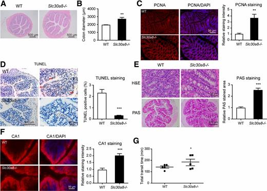Figure 5. Slc30a8−/− mice have altered intestinal tract morphology and motility. A: Representative hematoxylin-eosin (H&E) images of proximal colon from wild-type (WT) and Slc30a8−/− mice. B: Quantitative analysis of proximal colon diameter (n = 5 per genotype). C: Representative immunostaining and quantitative analysis of PCNA in WT and Slc30a8−/− proximal colon. D: Immunohistochemical staining and quantification of TUNEL assay in WT and Slc30a8−/− proximal colon (n = 3 per genotype). Arrowheads indicate positive staining signals. E: Representative H&E and PAS staining of goblet cells in mucosal layer from WT and Slc30a8−/− proximal colon. F: Representative immunostaining and quantitative analysis of CA1 in WT and Slc30a8−/− proximal colon. G: Total intestinal transit time of wild-type and Slc30a8−/− mice (n = 5 per genotype). Data are mean ± SEM. *P < 0.05, **P < 0.01, ***P < 0.001 by unpaired Student t test.