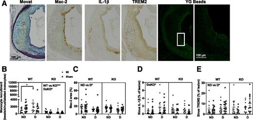 Figure 5. Integrin α4 regulates monocyte recruitment. Female Ldlr−/−;GpTg mice were fed a high-fat diet with 1.25% cholesterol for 12 weeks to initiate lesion formation, switched to chow, and lethally irradiated and transplanted with either WT or LysM-mediated KO bone marrow and allowed to recover for 5 weeks before injection with LCMV to induce diabetes (D) or saline (nondiabetic [ND]). Two weeks post–LCMV injection, mice were subjected to permanent ligation of the left anterior descending coronary artery (experimental MI) or a sham surgery and maintained for an additional 3.5 weeks. Mice were maintained on a low-fat semipurified diet from the onset of diabetes. A: Example of monocyte recruitment to the aortic sinus. From left to right: adjacent sections stained with Movat pentachrome, Mac-2, IL-1β, and TREM2 and YG latex beads (indicative of monocytes as described in research design and methods) in the aortic sinus, with the boxed area in higher magnification. B: Monocyte recruitment into the aortic sinus normalized to labeling efficiency. C: Mac-2 area in the aortic sinus expressed as % lesion. D: IL-1β area in the aortic sinus expressed as % lesion. E: TREM2 area in the aortic sinus expressed as % lesion. N = 11–18, *P < 0.05, ***P < 0.001 three-way ANOVA (WT vs. KO, nondiabetic vs. diabetic, sham vs. MI significance or as a significant interaction between two conditions [e.g., DxKO indicates that under diabetic conditions there is an effect of the KO]) and followed by Sidak multiple comparisons tests comparing groups that differ by one parameter (as indicated by lines with asterisks).