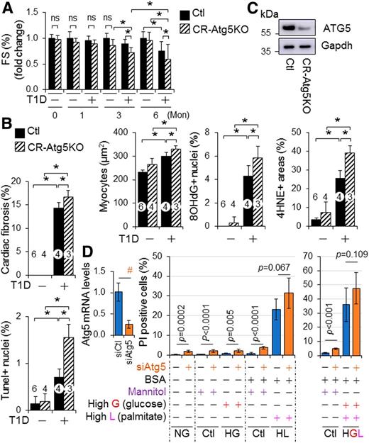 Figure 4. The role of cardiac autophagy in murine cardiomyopathy-associated STZ-induced diabetes. A–C: The impact of CR-Atg5KO on T1D-induced cardiomyopathy in mice. T1D in littermates of adult female MerCreMer+ Ctl and MerCreMer+::Atg5fl/fl (CR-Atg5KO) mice on a C57BL/6J genetic background after tamoxifen induction was induced by i.p. injection of STZ for 6 months (Mon), and T1D-induced cardiomyopathy was assessed as described in research design and methods. A: Cardiac function. B: Cardiac remodeling, apoptosis, and oxidative stress. Cardiomyocyte sizes and cardiac fibrosis, apoptosis, and oxidative stress were assessed in LVs of 6-month diabetic MerCreMer+ Ctl and MerCreMer+::Atg5fl/fl (CR-Atg5KO) mice after tamoxifen induction (n = 3–6). C: Tamoxifen-induced CR-Atg5 KO is confirmed by Western blot analysis using whole heart tissue lysates at each experimental end point. Animal numbers of each group in A are shown in Supplementary Fig. 19A. Animal numbers of each group in B are indicated in the parenthesis. *P < 0.05 between indicated groups. D: The impact of Atg5 knockdown on cell death in H9C2 cardiomyocyte-like cells under diabetes conditions. The set of experiments (n = 6) was carried out as described in research design and methods. #P < 0.05 between indicated groups. G, glucose; HG, high glucose to induce glucotoxicity; HGL, high glucose plus high lipid (PAs) loading to induce glucolipotoxicity; HL, high lipid (PAs) loading to induce lipotoxicity; L, lipid; NG, normal glucose.