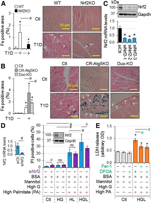 Figure 6. A potential axis of autophagy inhibition–Nrf2 activation–ferroptosis in cardiomyocytes induced by T1D. A: The impact of Nrf2KO on murine myocardial iron deposition in T1D. Iron deposition in LVs of adult male WT and Nrf2KO mice at 9 months after onset of T1D in Fig. 1 (n = 4) was quantified as described in research design and methods. B: The impact of Nrf2KO on CR-Atg5KO–exacerbated murine myocardial iron deposition in T1D. Iron deposition in LVs of adult female MerCreMer+ Ctl, CR-Atg5KO, and CR-Atg5KO and Nrf2KO (Duo-KO) mice at 9 months after onset of T1D in Fig. 5 (n = 3) was quantified as described in research design and methods. C: Efficiency of siNrf2 in knocking down Nrf2 in H9C2 cardiomyocyte-like cells. Upper panel shows the representative immunoblotting of Nrf2. Lower panel shows qPCR analysis of Nrf2 mRNA expression (n = 4). *P < 0.05 vs. siCtl (siRNA Ctl). Accordingly, siNrf2-2 was selected for the experiment of D. D: The effect of Nrf2 knockdown on H9C2 cell death in diabetes settings (n = 6). E: High-glucose and lipid milieu–induced ferroptosis in H9C2 cells (n = 4). DFOA, deferoxamine; HG, high glucose; HGL, high glucose plus high lipid (PAs) loading to induce glucolipotoxicity; HL, high PA loading. All experimental procedures are described in research design and methods. *P < 0.05 vs. Ctl in the same groups; #P < 0.05 between indicated groups.
