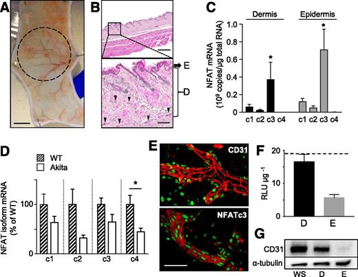 Figure 3. NFATc3 is the predominant NFAT isoform expressed in mouse skin. A: Whole mouse skin flat preparation (dermis face up) showing skin microvessels and a dashed circle representing the size of the area analyzed in laser Doppler imaging experiments. Scale bar, 5 mm. B: Hematoxylin and eosin–stained cross sections of mouse skin showing microvessels (arrowheads) in the dermis (D) layer (arrow indicates epidermis [E]). Scale bars, 500 μm (top panel); 100 μm (bottom panel). C: Absolute quantification of NFATc1–c4 mRNA in dermis and epidermis from nondiabetic C57Bl/6J mice, expressed as billion (109) copies per microgram total RNA. N = 3 mice/preparation. *P < 0.05. D: Gene expression analysis of NFATc1–c4 isoforms mRNA by quantitative PCR in the dermis from nondiabetic WT/NFAT-luc and diabetic Akita/NFAT-luc mice. N = 5 mice/group. *P < 0.05. E: Representative confocal images of skin whole mounts showing CD31 and NFATc3 (red) staining in microvessels. Nuclei are stained with SYTOX Green. Scale bar, 50 μm. F: NFAT-dependent transcriptional activity in dermis (D) and epidermis (E) homogenates from NFAT-luc mice, expressed as relative luciferase units (RLU) per microgram of protein. Dashed line indicates NFAT-dependent transcriptional activity in whole skin. N = 5 mice/group. G: Representative immunoblot showing expression of CD31 in whole skin (WS), dermis (D), and epidermis (E) from nondiabetic C57Bl/6J mice. α-Tubulin was used as loading control.