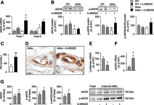 Figure 5. NFAT inhibition with A-285222 enhances eNOS expression and plasma NO levels. A: Gene expression analysis of eNOS mRNA by quantitative PCR in dermis from WT/NFAT-luc and Akita/NFAT-luc mice directly after (Post-1) and 9 weeks after (Post-2) treatment with A-285222 or vehicle. HPRT and cyclophilin B were used as endogenous controls, and data are expressed as percentage of vehicle-treated WT/NFAT-luc mice. N = 4–10 mice/group. B: Summarized data and representative immunoblots from Western blot experiments showing eNOS (left) and p-eNOS (middle) protein expression as well as p-eNOS/eNOS ratio (right) in the dermis of nondiabetic WT/NFAT-luc and diabetic Akita/NFAT-luc mice 9 weeks after A-285222 or vehicle treatment. Results are expressed as percentage of vehicle-treated WT/NFAT-luc mice. N = 11–15 mice/group. *P < 0.05, **P < 0.01 vs. WT. C: Plasma NO levels in Akita mice 4 weeks after treatment with A-285222 or vehicle as described in Fig. 1A. N = 5 mice/group. D: Immunohistochemistry images showing eNOS protein expression in skin microvessels directly after treatment with A-285222 (Post-1) as described in A. Scale bars, 5 μm. Gene expression analysis of luciferase (E) and eNOS (F) mRNA in dermis from WT/NFAT-luc mice after 24 h whole-skin organ culture in the presence or absence of A-285222 (1 µmol/L). N = 7 to 8 mice/group. For C, E, and F: *P < 0.05, **P < 0.01 vs. vehicle-treated mice of the same genotype. G: Summarized data from Western blot experiments showing eNOS (left) and p-eNOS (middle) protein expression as well as p-eNOS/eNOS ratio (right) in the dermis after whole-skin organ culture for 48 h with or without A-285222 (1 µmol/L). Included also are representative immunoblots of eNOS and p-eNOS protein expression in fresh and cultured dermis with or without A-258222. Data are expressed as percentage of the fresh sample. N = 10 for fresh and N = 8 mice/group for cultured samples. *P < 0.05 vs. fresh.