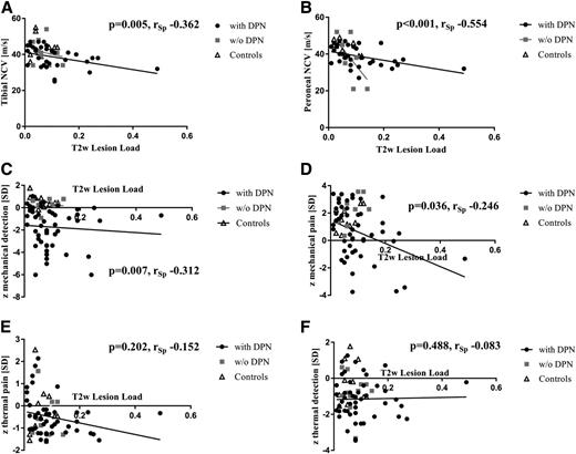 Figure 3. Correlation analysis of T2w lesion load with EPT and compound z scores in patients with type 2 diabetes with DPN, type 2 diabetes without DPN, and control subjects (as determined by NSS and NDS). A: Correlation between tibial NCV and T2w lesion load. B: Correlation between peroneal NCV and T2w lesion load. C: Correlation between compound z score for mechanical detection (comprising VDT and MDT) in QST and T2w lesion load. D: Correlation between compound z score for mechanical pain (comprising MPT and MPS) in QST and T2w lesion load. E: Correlation between compound z score for thermal pain (comprising CPT and HPT) in QST and T2w lesion load. F: Correlation between compound z score for thermal detection (comprising CDT, WDT, and TSL) in QST and T2w lesion load. w/o, without.