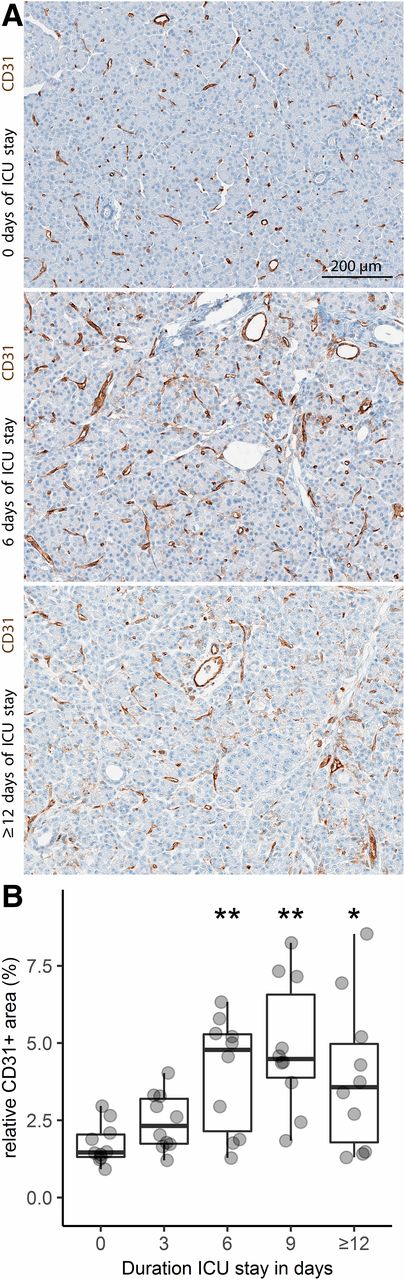 Figure 6. A: Immunostaining for the vascular marker CD31 in representative sections of human donor pancreas with 0, 6, and ≥12 days of stay in the ICU. B: Quantification of vascular density in human donor pancreas with increasing duration of stay in the ICU. Results are expressed as boxplots enriched with individual data points. Indications of significance reflect pairwise permutation tests with Hommel correction for multiple testing at the *P < 0.05 and **P < 0.01 level.