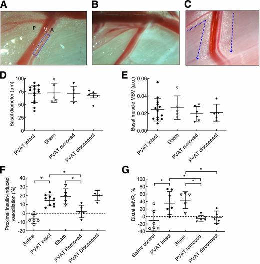 Figure 3. Removal of healthy PVAT specifically impairs insulin-induced vasodilation and microvascular recruitment in muscle. A–C: Gross appearance of the proximal gracilis muscle vasculature after sham (A), PVAT removal (B), and PVAT disconnection surgery (C). In panel A, P indicates PVAT, V indicates the muscle venule, and A indicates the muscle resistance artery. Intravital microscopy of the muscle resistance artery was performed on the artery segment indicated by the rectangle in A. In panel C, the arrows indicate the locations of the surgical cuts. D and E: Basal resistance artery diameter and MBV in muscle were not affected by surgical removal of PVAT or by microsurgical disconnection of PVAT from adjacent muscle. F and G: Effects of PVAT manipulation on effects of insulin’s microvascular actions in vivo (infusion rate 7.5 mU/kg/min) in the proximal and distal muscle microcirculation. F: PVAT removal, but not separation, from adjacent muscle (disconnect) abolishes insulin-induced vasodilation of the proximal GA in vivo. G: Both PVAT removal and PVAT disconnection from adjacent muscle abolish insulin-stimulated distal microvascular recruitment in muscle. Data are mean ± SD and were tested with one-way ANOVA with Tukey post hoc analysis. *P < 0.05. a.u., arbitrary unit.