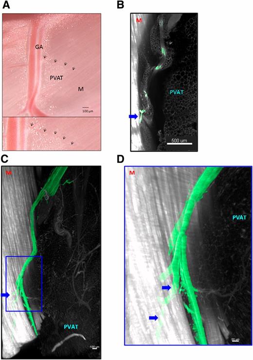 Figure 4. Arteriolar connections between PVAT and adjacent muscle. A: Adipomuscular arteriole between PVAT and muscle observed using light microscopy. Arrows indicate the arteriole connecting the GA to the adjacent muscle (M) in the medial hind limb. The bottom panel shows zoomed-in, large-magnification images. B: Two-dimensional image of the PVAT-muscle interface of the gracilis muscle with adipomuscular arterioles (arrow), identified by VeCadherin-Cre-driven endothelial expression of GFP (indicated in green). mTomatoRed-positive muscle fibers and PVAT depicted in white. C and D: Three-dimensional visualization of adipomuscular arterioles determined by light sheet fluorescence microscopy. Stacked light sheet fluorescence microscopy image (left) of a cleared biopsy from the medial hind limb (segment shown in Supplementary Data) showing microvessels connecting PVAT around the GA to the adjacent muscle (M). The enlarged segment in panel D is indicated by the blue rectangle; the segmented stacked image shows the GA in green and PVAT and muscle in white.