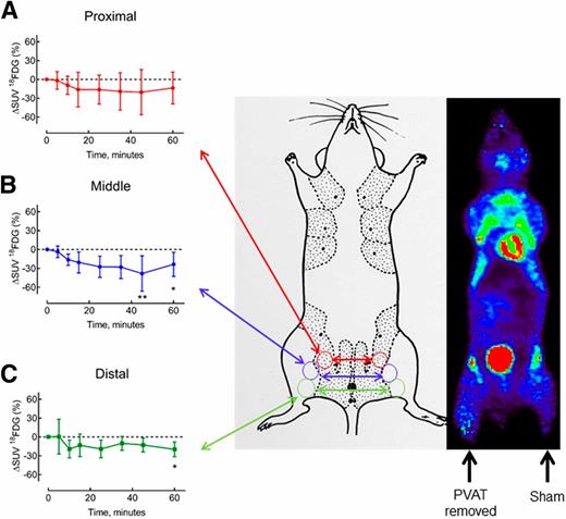 Figure 5. PVAT removal decreases insulin-induced muscle glucose uptake in vivo. A representative coronal PET image shows 18FDG in mice (60 min after injection). In offline analysis, three circular ROIs (16 mm2 each) were determined a priori and drawn on each hind limb medial to the femur: proximal (starting distal to the bladder), middle, and distal (proximal to the knee). A–C: Differences in standardized uptake value (ΔSUV) of 18FDG between the PVAT-removed hind limb and sham hind limb expressed as percentage of uptake in the sham-operated hind limb (mean ± SD; n = 5). A negative value indicates lower uptake in the PVAT-removed hind limb. Data were tested using paired t test. *P = 0.04, **P = 0.009.