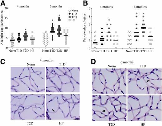 Figure 2. Histopathology in retinal microvasculature. Trypsin-digested microvasculature from rats, 4 and 6 months after Stz administration, was stained with PAS, and acellular capillaries (A) and pericyte ghosts (B) were counted. The values in the histograms are means ± SD from 6–10 rats/group each at 4 and 6 months’ duration. C and D: The representative PAS-stained images are from rats at 4 and 6 months’ duration, respectively, and their age-matched controls (Norm and HF, respectively). The arrows indicate acellular capillaries. *P < 0.05 vs. age-matched normal rats.