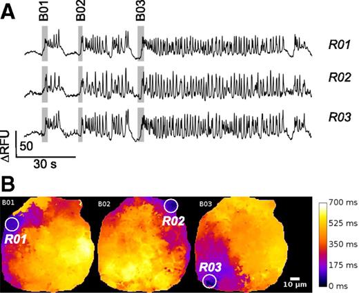 Figure 4. No evidence of hub cells from optical imaging of β-cell electrical activity. A: Electrical activity in three regions (R01–R03) within an islet expressing the membrane potential sensor Optopatch2. Responses are shown as the changes in relative fluorescence units (RFU). The gray rectangles superimposed on the traces highlight three successive bursts of electrical activity (B01–B03). B: Spread of electrical activity across the islet. The delay with respect to the first point at which electrical activity was detected is displayed in pseudocolors with black corresponding to no delay and white to delay of 700 ms. Note that bursts B01, B02, and B03 are initiated in three different spatially separated areas of the islet (R01–R03: white circles). The measurements in A were taken from these regions.