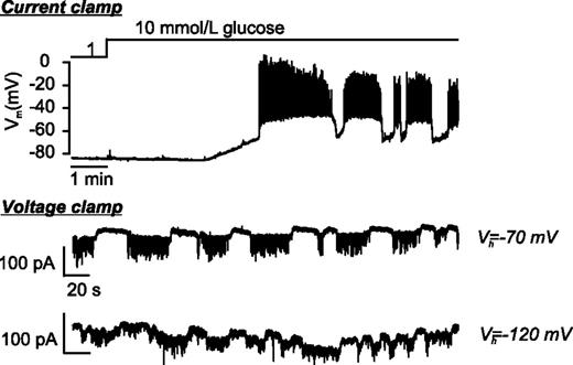 Figure 5. Hyperpolarization of β-cells does not affect electrical activity in neighbors. Changes in β-cell membrane potential when increasing glucose from 1 to 10 mmol/L recorded under current-clamp conditions (top) and under voltage-clamp conditions when holding the membrane potential at −70 mV (middle) or −120 mV (bottom). The current oscillations reflect glucose-induced electrical activity in neighboring (unclamped) β-cells. The bottom trace appears noisier at −120 mV because of membrane breakdown (partial seal rupture) around the recording electrode at this unphysiologically negative membrane potential.