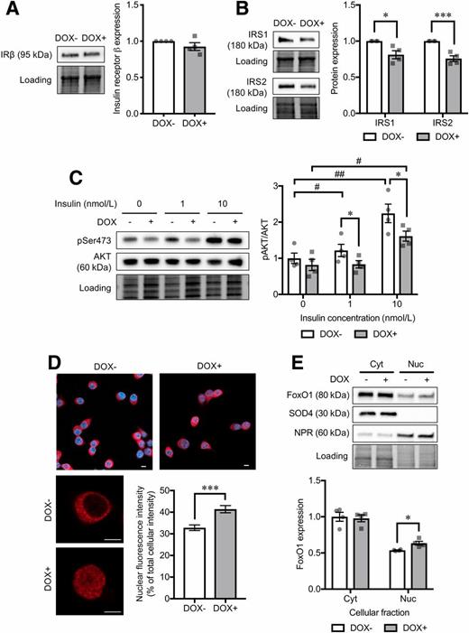 Figure 5. Analysis of insulin-signaling cascade in CD36-overexpressing INS-1 cells. Protein levels of insulin receptor β subunit (IRβ) (A) and IRS1 and IRS2 (B) in INS-1 cells without (DOX−) or with doxycycline-induced CD36 overexpression (DOX+). Normalization factor was used to adjust the target band intensity. N = 4 for each group. C: Phosphorylation levels of AKT Ser473 (pSer473) under a short-term (10-min) stimulation of insulin with various doses (1 and 10 nmol/L). Phosphorylated protein signals were normalized to the total protein levels. N = 4 for each group. D: Immunocytochemical analysis of FoxO1 (red) localization. Nuclei were stained with DAPI (blue). The bar graph shows nuclear FoxO1 fluorescence intensity normalized to the whole-cell intensity. Scale bars, 5 µm. N = 21 cells for each group. E: Western blot analysis of cytoplasmic (Cyt) and nuclear (Nuc) protein levels of FoxO1. N = 4 for each group. The total protein images obtained using the Stain-Free technology are shown as a loading control (Loading). The P values were determined by Student two-tailed t test (unpaired). *P < 0.05, ***P < 0.001 vs. DOX− under the same condition; #P < 0.05, ##P < 0.01 vs. cells without the stimulation of insulin (0 nmol/L) for each group (DOX− or DOX+).