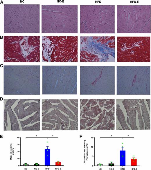 Figure 3. Effects of EMPA treatment on fibrosis and lipid accumulation. A: Representative hematoxylin and eosin staining. B: Masson trichrome staining. C: Picrosirius red staining. D: Oil Red O staining. E: Collagen volume fraction (CVF). F: Picrosirius red staining, fibrotic area. Original magnification ×400; n = 4/group. *P < 0.05.