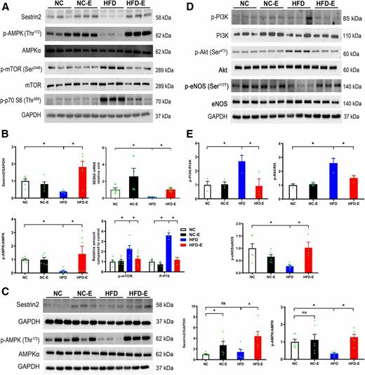 Figure 5. Effects of EMPA treatment on the Sesn2-AMPK-mTOR and PI3K-Akt-eNOS signaling pathways. A and B: Western blot analysis of Sesn2, AMPK, mTOR, and p-S6 and RT-PCR analysis of Sesn2 mRNA from myocardial tissue. n = 3–6 mice/group. C: Western blot analysis of Sesn2 and AMPK in isolated cardiomyocytes treated with EMPA for 2 h. n = 6 mice/group. D and E: Western blot analysis of PI3K, Akt, and eNOS from myocardial tissue. n = 3–6 mice/group. *P < 0.05. p-, phosphorylated.