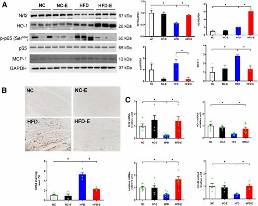 Figure 6. Effects of EMPA treatment on redox homeostasis–related protein levels. A: Western blot analysis of Nrf2, HO-1, p–NF-κB p65, and MCP-1 from myocardial tissue. n = 3 mice/group. B: Immunohistochemistry for CD68 expression. n = 4 mice/group. C: Real-time PCR for Nrf2, HO-1, catalase, and GCLM. n = 4–8 mice/group. *P < 0.05.