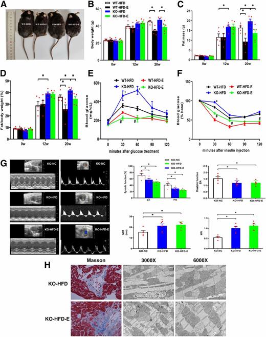 Figure 7. Effects of EMPA treatment on BW, body composition, biochemical parameters, and cardiac function in Sesn2 KO-HFD mice. A: Morphology and BW of mice. B: Weekly BWs (n = 5/group). Six-week-old male mice were fed the HFD for 12 weeks and then treated with or without EMPA for another 8 weeks (end point at 20 weeks). C: Body fat mass of the mice (n = 5/group). D: Body fat/BW (n = 5/group). E: Oral glucose tolerance test (n = 4–6/group). F: Insulin tolerance test (n = 4–6/group). G: Cardiac function: EF, FS, E/A, IVRT, and MPI. n = 6 to 7/group. H: Masson trichrome staining and mitochondrial morphology, as examined by transmission electronic microscopy (original magnification ×3,000 and ×6,000). KO-HFD-E, KO-HFD and EMPA; KO-NC, Sesn2 KO mice with normal chow diet; WT-HFD-E, WT-HFD and EMPA. *P < 0.05.