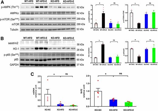 Figure 8. Effects of EMPA treatment on the Sesn2-AMPK-mTOR pathway and redox homeostasis in Sesn2 KO-HFD mice. A: Western blot analysis of AMPK and mTOR from myocardial tissue. n = 3–6 mice/group. B: Western blot analysis of HO-1 and p65 from myocardial tissue. n = 3 mice/group. C: Real-time PCR for mtDNA and Nrf2. n = 4–6 mice/group. KO-HFD-E, KO-HFD and EMPA; KO-NC, Sesn2 KO mice with normal chow diet; WT-HFD-E, WT-HFD and EMPA. *P < 0.05. p-, phosphorylated.