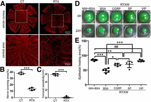 Figure 1. Neuropeptides enhance severely impaired epithelial wound healing in the denervated B6 mouse corneas. A: Anesthetized mice were treated with one drop of the vehicle or 200 ng/μL RTX for 10 min. Control (CT) and RTX-treated mouse corneas were collected and subjected to WMCM with β-tubulin III staining. A (top): Whole corneal images of SN fibers/endings. A (bottom): High-magnification images showing the central, marked areas of the corneas. Scale bars are as indicated. B: Nerve densities at the central areas (bottom panel in A) were calculated from the areas covered with β-tubulin III staining with ImageJ and presented as percent areas (mean ± SD; n = 4). ***P < 0.001 (Student t test). Two independent experiments were performed. C: The sensitivity of the CT and RTX-treated corneas was measured using an aesthesiometer and presented as the length of the threads (maximum 6 cm). D: Control or RTX-treated corneas pretreated with recombinant CGRP (100 ng/eye), SP (250 ng/eye), and VIP (250 ng/eye) or BSA as the control 4 h prior to epithelium debridement. At 0 h (0H), the corneas were wounded by epithelium debridement (2-mm diameter). At 22 hpw (22H), the remaining wounds were stained with fluorescein and photographed. E: The wound sizes were calculated using ImageJ and presented as percentage of healed area over the size of the original wound (mean ± SD; n = 5). *P < 0.05, **P < 0.01, ***P < 0.001 (one-way ANOVA). RTXW, RTX wounded.