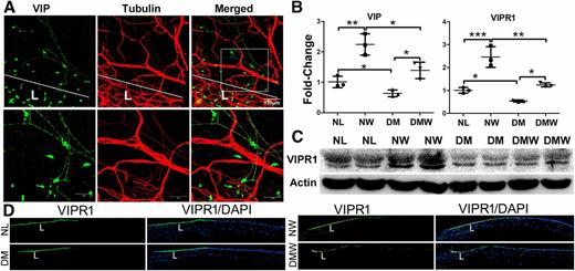 Figure 3. Wound-induced VIP and VIPR1 upregulation was suppressed in diabetic corneas. A: Costaining of VIP and β-tubulin III in NL corneas was performed, and images of the limbal region of corneas were captured (top panels), with high-magnification images in bottom panels. B: STZ-induced diabetic and age-matched NL mice were wounded by epithelium debridement (2-mm diameter), and the epithelial cells (CECs) were collected as the NW. At 22 hpw, CECs that had migrated into the original wounds were scraped off from the corneas and collected as wounded (W) CECs. CECs collected were subjected to RNA isolation for qPCR to assess Vip and Vipr1 expression. *P < 0.05, **P < 0.01, ***P < 0.001 (two-way ANOVA). C: Samples collected as described in B were also subjected to Western blotting analysis (two samples per lane represent each condition) for VIPR1 expression, with actin as the internal loading control. D: At 22 hpw, wounded corneas along with unwounded as the control were excised, snap-frozen in OCT, and cryostat sectioned. Cornea sections were stained with VIPR1 antibody (green) and counterstained with DAPI showing nuclei (blue). For each set of experiments, optimization of the exposure time and other settings was determined using NL healing corneas, and the same settings were kept during image acquisition. Images shown were representatives of three corneas for each condition. L, limbus; NLW, NL wounded.