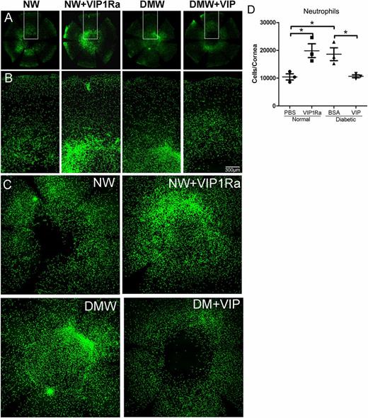 Figure 6. VIP dampens neutrophil infiltration in NL and diabetic healing corneas. NL (NW), pretreated with VIP1Ra (NW+VIP1Ra), and diabetic (DMW), pretreated with recombinant VIP (DMW+VIP), mouse corneas were wounded by epithelium debridement (2-mm diameter). Healing corneas collected at 22 hpw from NL and diabetic mice were subjected to WMCM using Ly6G-FITC antibody for mouse neutrophil staining. The images of the whole cornea were captured (A), the marked areas of whole corneas were amplified (B), and central areas were shown (C). D: Cell numbers in the whole corneas (A) were calculated with ImageJ and presented (mean ± SD; n = 3). Two independent experiments were performed. *P < 0.05 (one-way ANOVA).