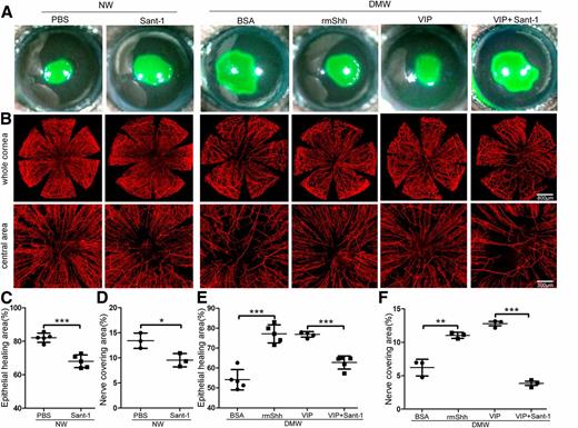 Figure 8. Shh accelerates diabetic wound healing and nerve regeneration as a downstream signal pathway of VIP in B6 mouse corneas. NL (NW), pretreated with Sant-1 (250 nmol/L, 5 μL/eye) and diabetic (DMW) corneas, pretreated with recombinant mouse Shh (rmShh) (50 ng/μL, 5 μL/eye), VIP (50 ng/μL, 5 μL/eye), and VIP+Sant-1 (250 nmol/L, 5 μL/eye) 4 h prior to epithelium debridement. At 0 h, the corneas were wounded by epithelium debridement (2-mm diameter). A: At 22 hpw, healing corneas were stained with fluorescein and photographed, and the wound healing was calculated using ImageJ and presented as a percentage of the original wound size (C and E; mean ± SD, n = 5). At 3 days postwounding, epithelium-healed corneas were subjected to WMCM for nerve staining of the whole cornea (B, top panels) and high-magnification images of central areas (B, bottom panels) using β-tubulin III antibody. Each image is a representative of three corneas in a group. Nerve densities at the central areas (bottom panels) were calculated from the areas covered with β-tubulin III staining with ImageJ and presented as percent areas (D and F). Two independent experiments were performed. *P < 0.05, **P < 0.01, ***P < 0.001 (Student t test).