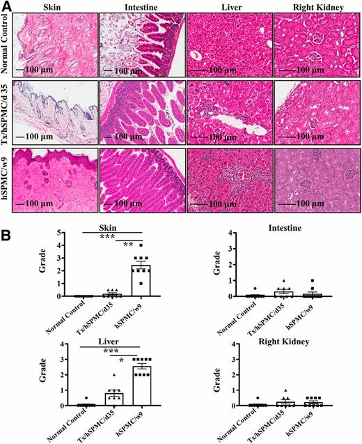Figure 3. Histological evaluation of GVHD in hNSG mice and transplanted hNSG recipient mice. A: Representative H-E micrographs of skin and intestine (original magnification ×10) and liver and right kidney (original magnification ×20) in the NSG mice without transfusion of hSPMCs (normal control), NSG recipient mice with 1 × 107 hSPMCs at day 35 (Tx/hSPMC/d35), and NSG mice with 1 × 107 hSPMCs at week 9 (hSPMC/w9) after transfusion. B: Histological scores of skin, intestine, liver, and kidney damage grades (0–4) for normal control (n = 9), Tx/hSPMC/d35 (n = 8), and hSPMC/w9 groups (n = 9). Kruskal-Wallis test followed by Dunn multiple comparison test was used for comparisons. Error bars indicate mean ± SEM. *P < 0.05, **P < 0.01, ***P < 0.01.