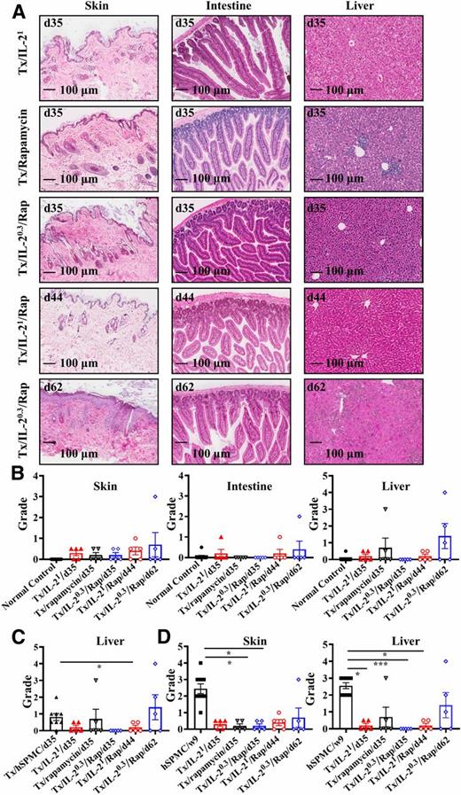 Figure 6. Histological evaluation of GVHD in transplanted and hNSG mice after treatment with IL-2 and/or rapamycin. A: Representative H-E micrographs of skin, intestine, and liver (original magnification ×10) from the transplanted NSG mice transfused with 1 × 107 hSPMCs and treated with IL-21, rapamycin, and IL-20.3/rapamycin at day 35 (d35) and/or d62 after transfusion, and IL-21/rapamycin at d44 after transfusion. Histological scores of skin, intestine, and liver damage grades (0–4) from hNSG recipient mice with IL-21 (Tx/IL-21/d35), rapamycin (Tx/rapamycin/d35), IL-20.3/rapamycin (Tx/IL-20.3/Rap/d35), and IL-21/rapamycin (Tx/IL-21/Rap/d44) at d35–d44 after transfusion and IL-20.3/rapamycin at 62 days after transfusion (Tx/IL-20.3/Rap/d62) (n = 5 for every group) compared with NSG mice without transplantation and transfusion (n = 9) (normal control) (B), NSG recipient mice without treatment at d35 after hSPMCs transfusion (n = 8) (Tx/hSPMC/d35) (C), and hNSG mice at week 9 (n = 9) (hSPMC/w9) (D). Kruskal-Wallis test followed by Dunn multiple comparison test was used for comparisons. Error bars indicate mean ± SEM. *P < 0.05, ***P < 0.001.