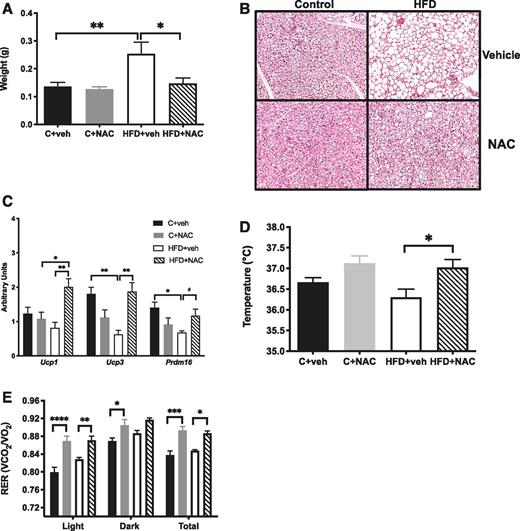 Figure 4. NAC treatment prevented BAT hypertrophy and increased expression of thermogenic genes and core body temperature in HFD offspring. A: NAC prevented the increase in BAT weight compared with HFD+vehicle (n = 5–6/group). B: NAC decreased the lipid droplet size seen with H-E staining in HFD+vehicle (original magnification ×200) (n = 3/group). C: NAC increased mRNA expression of thermogenic genes (n = 5–6/group). D: NAC increased core body temperature of HFD offspring (n = 5–6/group). E: NAC increased respiratory exchange ratio (RER) in the light and dark cycle of C and HFD offspring (n = 4/group). *P < 0.05, **P < 0.01, ***P < 0.001, ****P < 0.0001; #P < 0.05 by ANOVA. veh, vehicle.