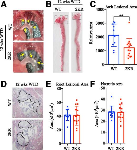 Figure 1. PPARγ deacetylation inhibits aortic arch atherosclerosis. Male mice on an Ldlr−/− background (11 WT and 14 2KR mice) were fed the WTD for 12 weeks (wks). A: Representative images of aortic arches. The yellow arrows indicate plaques. **P < 0.01, two-tailed Mann-Whitney U test. B: En face aortic plaque analysis with Oil Red O staining. The quantified arch lesion areas are shown in the dashed squares. C: Quantification of aortic arch plaque areas. D: Representative H&E staining of aortic root sections. Plaques are outlined in black. E and F: Quantification of total lesion area (E) and necrotic core area (F) of aortic root sections. Data in C, E, and F are presented as the mean ± SEM.