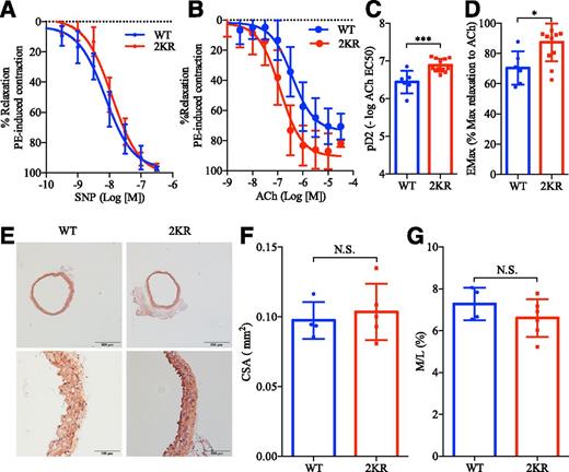 Figure 7. PPARγ deacetylation enhances endothelial function in aortae from 8-week-old male mice. A: Curves of endothelium-independent relaxation in response to SNP (1 nmol/L to 10 μmol/L) (6 WT mice, 10 2KR mice). B: Curves of endothelium-dependent relaxation in response to ACh (1 nmol/L to 10 μmol/L) (8 WT mice, 13 2KR mice). C: Vascular sensitivity, plotted as pD2 (−log of the half-maximal effective concentration [EC50]) of Ach (6 WT mice, 12 2KR mice). D: Maximum aortic relaxation in response to ACh in male mice (6 WT mice, 12 2KR mice). E: Representative images of aortae from WT and 2KR mice stained with H&E (magnification ×4 [top] and ×20 [bottom]). F and G: Measurements of the cross-sectional area (CSA) (F) and media-to-lumen ratio (M/L) (G). *P < 0.05, ***P < 0.001, WT vs. 2KR mice, two-sided Student t test. Data are presented as the mean ± SEM. N.S., not significant.
