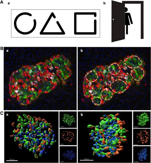 Figure 3. Human islet architecture and the Gestalt principles of continuity and closure. A: (a) A simplified illustration demonstrating the principle of closure using three basic shapes. The mind tends to automatically complete the closure of these incomplete shapes, and they can be easily recognized as a circle, triangle, and square. (b) The principle of continuity helps us recognize a person when only a partial figure is present. When only part of a unique object is readily available for observation, the mind tends to “continue” its existence in order to accurately identify the unknown object. B: (a) 2D image of a human islet immunostained for insulin (green), glucagon (red), somatostatin (gray), and DAPI (blue). (b) Dashed lines highlighting regions perceived as individual “subunits” due to the non–β-cell arrangement. Although these individual “subunits” are incomplete in the 2D view, the principles of continuity and closure make it easier to group each area as its own contained subunit. This occurs despite the intermittent breaks in the subunit “mantle” of non–β-cells and “core” of β-cells. C: (a) 3D rendered view of a human islet. Insulin (green), glucagon (orange), and somatostatin (blue). Views of individual channels are shown on the right. (b) Side view of Ca. In 3D, the whole-islet distribution of endocrine cells can be appreciated, especially with regard to the localization of individual types of endocrine cells. Visualization in 3D essentially captures all possible 2D slices that may exist within the islet, allowing the observer to better appreciate the true lack of continuity of “subunit” formation. Scale bars: all 50 μm.