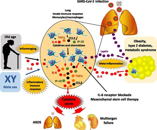 Figure 1. Age, male sex, and excess adiposity interact with SARS-CoV-2 infection to produce the perfect cytokine storm. Obesity, type 2 diabetes, and metabolic syndrome are characterized by excess adipose tissue leading to meta-inflammation with production of proinflammatory cytokines like IL-6 that dysregulate innate immune cells of the lungs. In obesity, hyperleptinemia also acts as a proinflammatory cytokine on lung airway epithelial cells, immune cells, and fibroblasts creating a local inflammatory state. Aging is associated with dysregulation in immune functions and inflammaging with increased systemic proinflammatory cytokines, including IL-6. Male sex is also characterized by an intrinsic propensity to meta-inflammation. Upon SARS-CoV-2 infection, the cumulative effects of old age, male sex, and excess adiposity produce a state of heightened meta-inflammation, which skews immune cells to produce more chemokines and inflammatory cytokines, attracting more inflammatory cells, ultimately leading to a cytokine storm.
