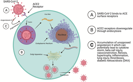 Mechanism of SARS-CoV-2 entry to the cell through ACE2 receptors and interaction with the renin-angiotensin-aldosterone system (RAAS). SARS-CoV-2 binds to ACE2 receptors commonly found on the surface of organs and tissue cells. Through endocytosis, the virus fuses through the host cell membrane. Then the nucleocapsid uncoats and viral RNA interacts with ribosomes near the nucleus to undergo replication and translation, hence producing viral proteins and RNA. Afterward, viral proteins and RNA pass are modified, assembled, and packaged through the Golgi–endoplasmic reticulum complex. Through exocytosis, the virus can exit the host cell and further infection. In the process, ACE2 can downregulate and inhibit the conversion of angiotensin II to angiotensin (1–7), a hormone that opposes the harmful molecular and cellular effects of angiotensin II. The overaccumulation of angiotensin II can lead to several complications in patients including cytokine storms, β-cell dysfunctioning, vasoconstriction, fibrosis, hypertrophy, inflammation, lung injury, thrombosis, and diabetic ketoacidosis (DKA). This mechanism is suggested to be involved with the development of new-onset diabetes in COVID-19 patients.