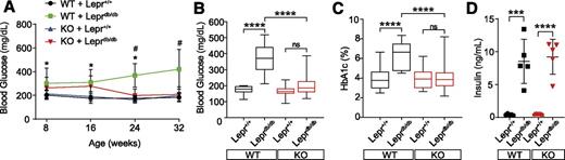Figure 1. CaMKIIδ-deficient Leprdb/db mice are hyperinsulinemic but not hyperglycemic. A: Time course showing blood glucose levels over 32 weeks in Lepr+/+ and Leprdb/db mice, with or without CaMKIIδ deficiency. Concentration of blood glucose in Leprdb/db/KO mice is reduced to normoglycemic levels from 24 weeks of age. B: Levels of blood glucose are shown in animals at 24 weeks of age. C: Levels of HbA1c are increased in Leprdb/db/WT and blunted in Leprdb/db/KO mice. D: Plasma insulin levels are increased to an equal level in both Leprdb/db groups. Numbers of animals investigated are n ≥ 7 in box and whisker plots or indicated as symbols in each group. Values are expressed as mean and SD in scatter plots and as mean and minimum to maximum in box and whisker plots. *P < 0.05 Leprdb/db vs. Lepr+/+, #P < 0.05 Leprdb/db vs. Leprdb/db/KO, ***P < 0.001, ****P < 0.0001.